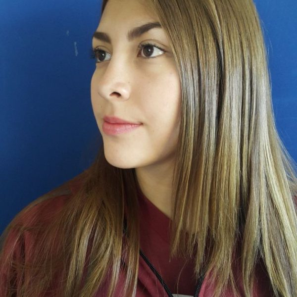 Cirugía rinoplastia punta nasal dr efrain lopez