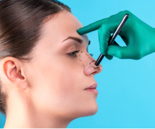 Otorrinolaringólogo Quito Dr. Efraín López Rinoplastia Quito