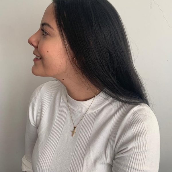 Rinoplastia Quito Dr Efrain Lopez Otorrinolaringologo Caso 1 Despues-min Rinoplastia Quito Dr Efrain Lopez Otorrinolaringologo Caso 5 Despues-min