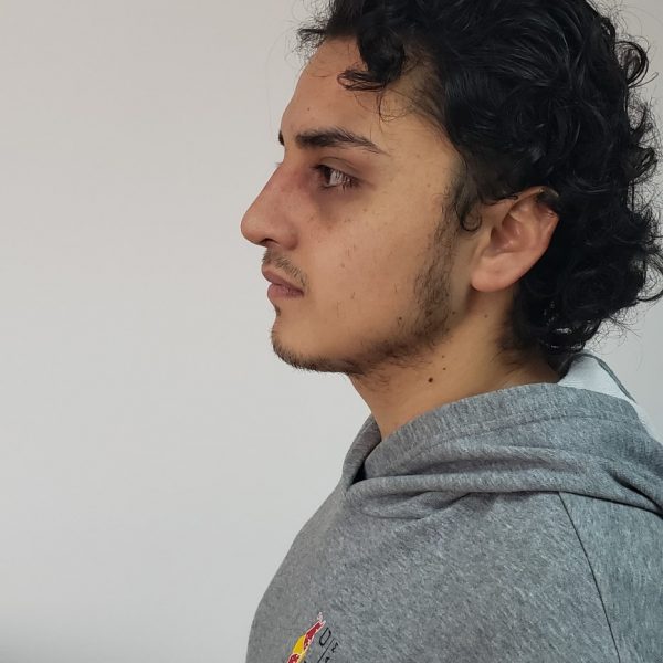 Rinoplastia Quito Dr Efrain Lopez Otorrinolaringologo Caso 2 Despues-min Rinoplastia Quito Dr Efrain Lopez Otorrinolaringologo Caso 5 Despues-min